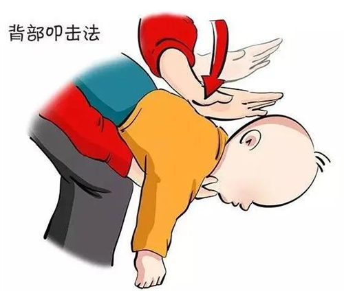 异物卡喉的急救.png